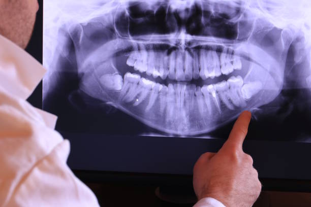 Best Emergency Treatment for Oral Infections in Cochituate, MA