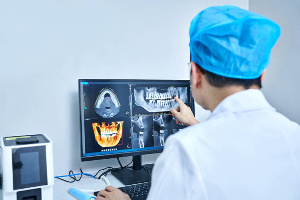 Best Knocked-Out Tooth (Avulsed Tooth) Treatment in Cochituate, MA